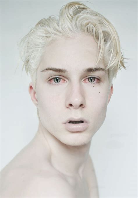 albino online dating